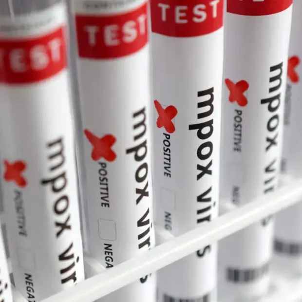 China relata cinco casos da nova variante de mpox